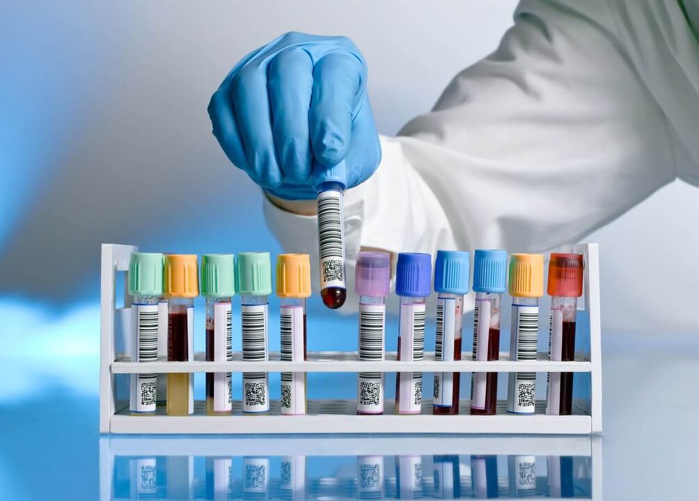Test de sânge pentru descărcare patologică în timpul excitării