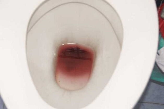 Apariția bărbaților atunci când sunt treziți